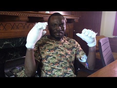 Asylum seeker who almost froze to death may lose hands