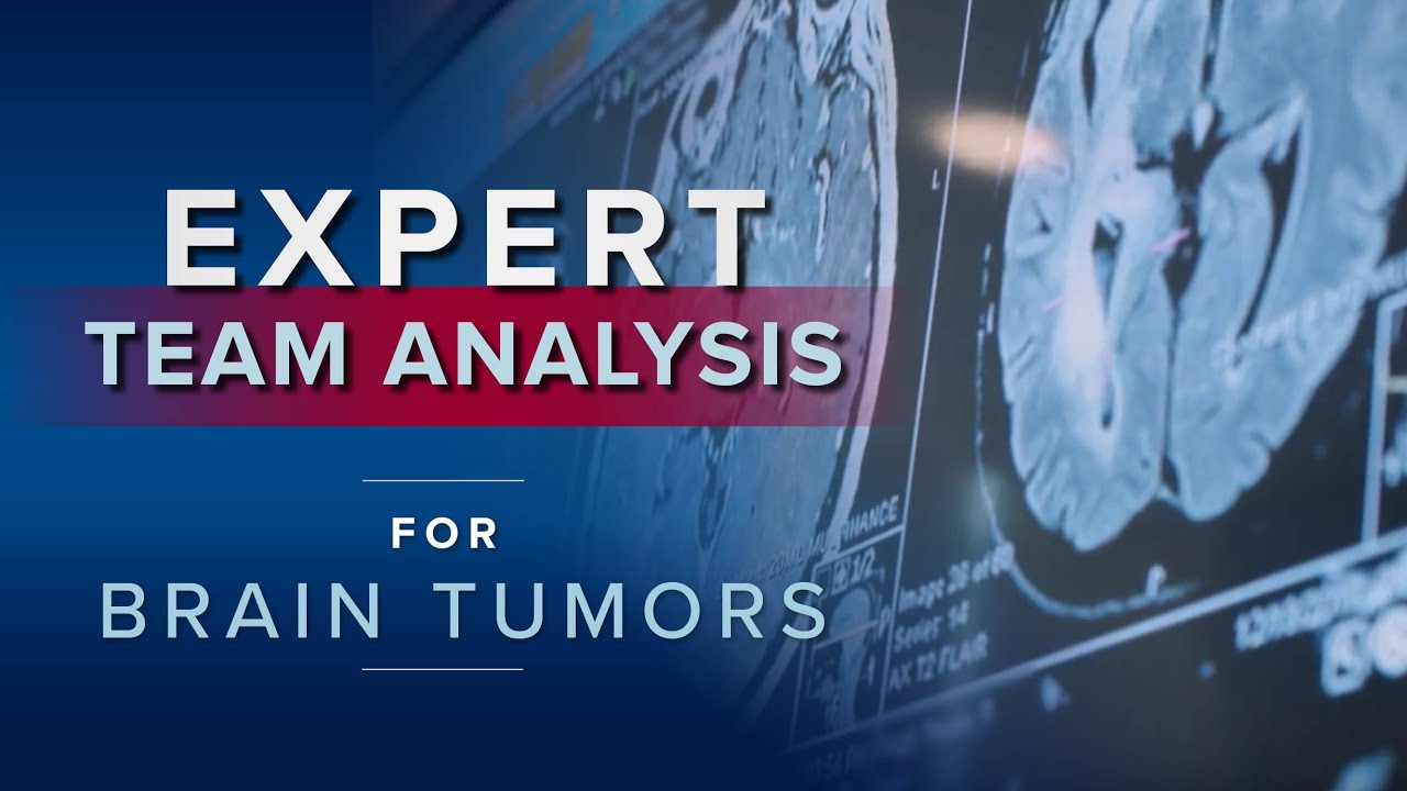 Watch video titled Weekly Tumor Board Meetings at the Penn Brain Tumor Center on YouTube