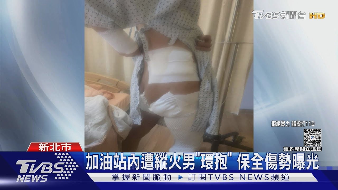 加油站內遭縱火男「環抱」保全傷勢曝光