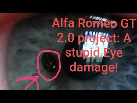 Alfa Romeo GT 2.0 project: A stupid eye damage from the metal grinder in the last video