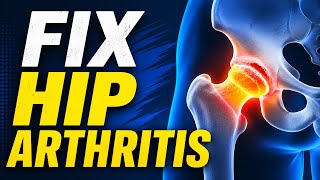 10 Things I Learned After Helping 2,164 People With Hip Arthritis