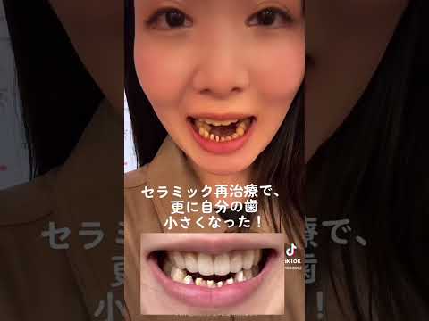 フラワーラッシュ - 定義