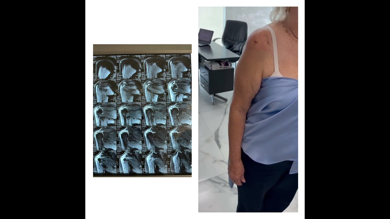 Diego Gomez Orozco-13