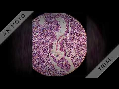 (VLOG 42) Histology of the female reproductive system.