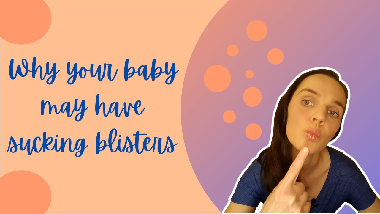 Can babies get milk blisters on their lips?