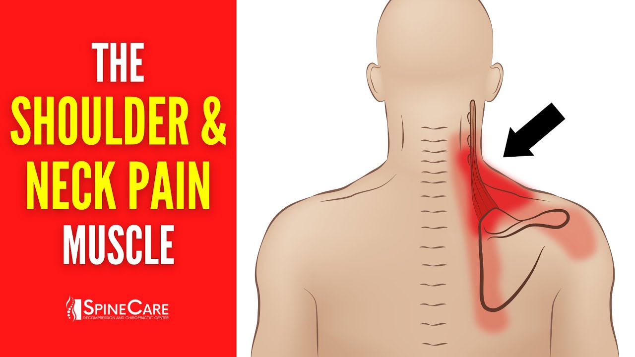 The Neck and Shoulder Pain Muscle (How to Release It for INSTANT RELIEF)