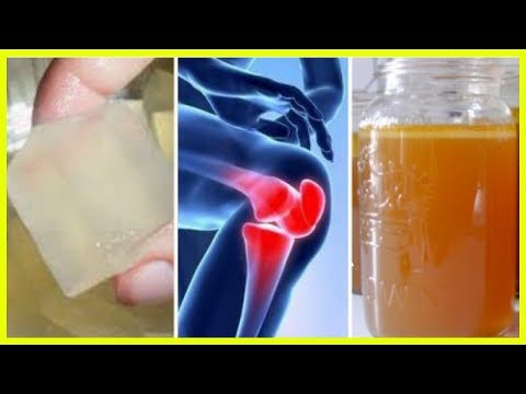 Von und zu den Schmerzen im Sprunggelenk Einseitige Kopfschmerzen mit Symptomen der zervikalen Osteochondrose