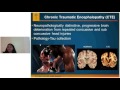 Dr. Verghese - Concussion Diagnosis and Management