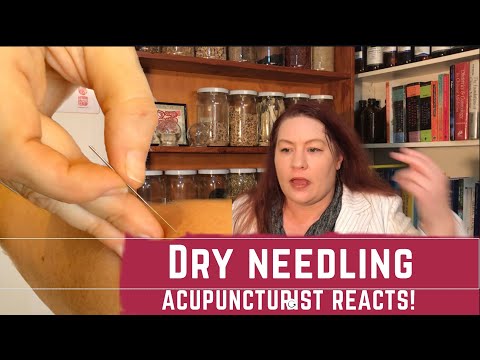 Acupuncturist Reacts -  Dry Needling Websites get it WRONG