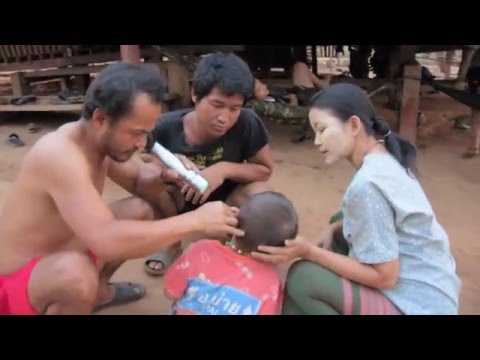 Moj život 98 - Hirurg iz džungle Mijanmara - Ponedjeljak 17:00