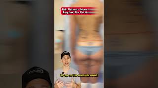 Lampert Md Plastic Surgery