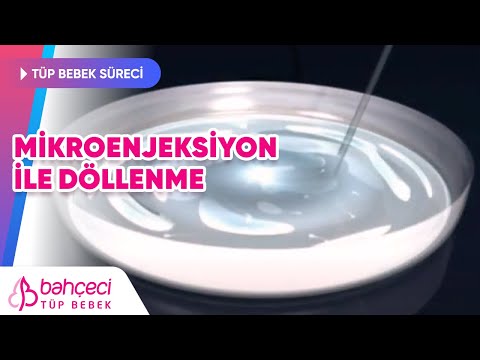 Döllenme – Mikroenjeksiyon ile Döllenme