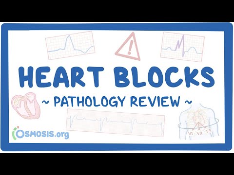 Cystic fibrosis pathology review