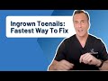 Ingrown Toenails What Is The FASTEST Way To Get Rid Of Them