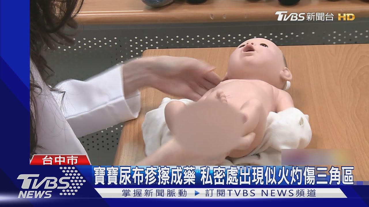 寶寶尿布疹擦成藥 私密處出現似火灼傷三角區