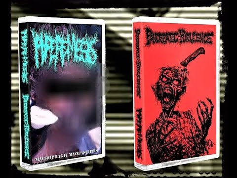 HYPEREMESIS / PANCREATIC PURULENCE - Split Tape (2016)