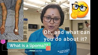 Lipoma information