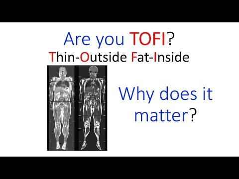 Visceral versus subcutaneous fat - The TOFI phenotype