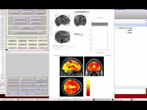K-Means Analysis in FMRI Data, Part 1