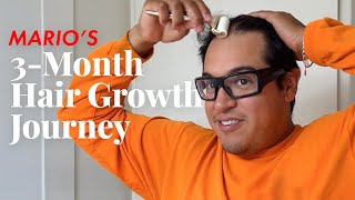 Sephora Mario’s 3-Month Hair Growth Journey | Sephora