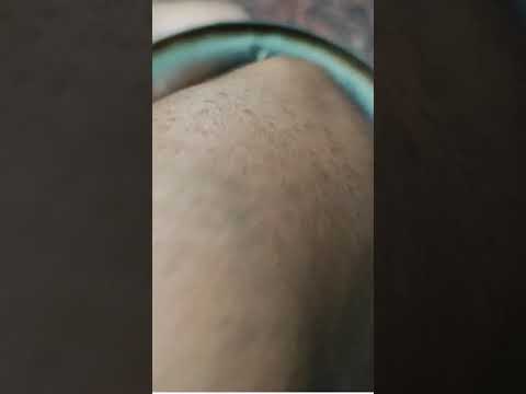 താരൻ മാറാൻ easy hairpack at home||anti-dandruff treatment|| #shortsmalayalam #shorts #shorts