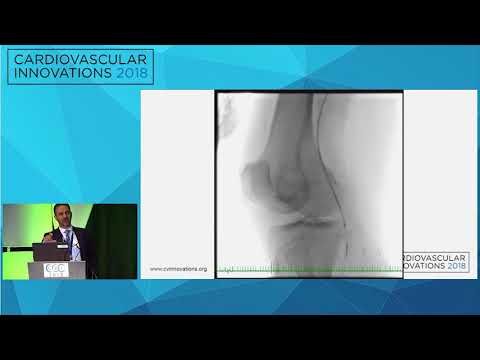 CVI2018 Session: DCB, DES, wire interwoven, or covered stents - Mehdi Shishehbor, DO, MPH, PhD