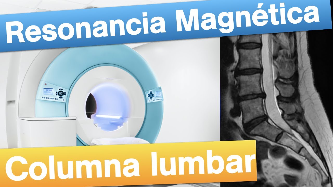 Watch Resonancia magnética Lumbar - Cuándo y cómo se realiza. Now Resonancia magnética Lumbar - Cuándo y cómo se realiza.