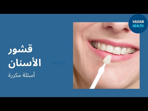 الأسئلة المتداولة حول قشرة الأسنان