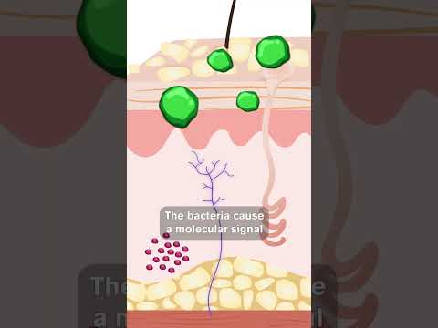 Cause of Chronic Itching Revealed by Harvard Researchers