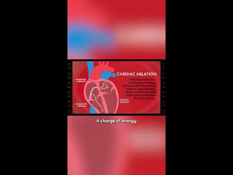 How Ablation Works