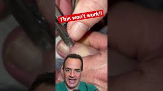 DOCTOR REACTS: HOW TO NOT REMOVE AN INGROWN TOENAIL! #shorts