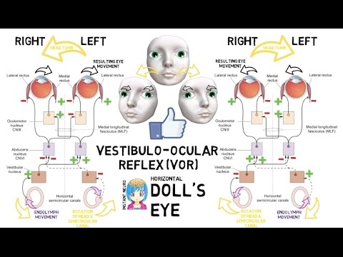 INSTANT NEURO - Doll's Eye