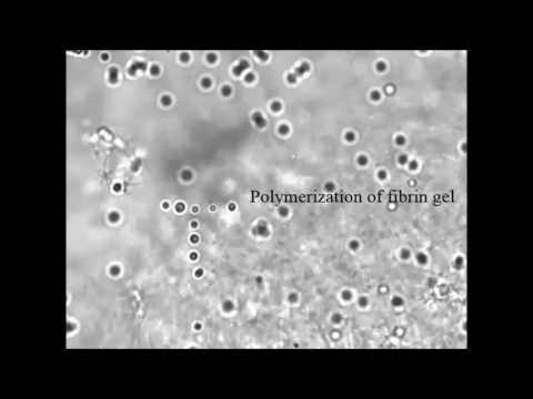 Effect of fibrin gel formation on trapped silica microspheres pattern