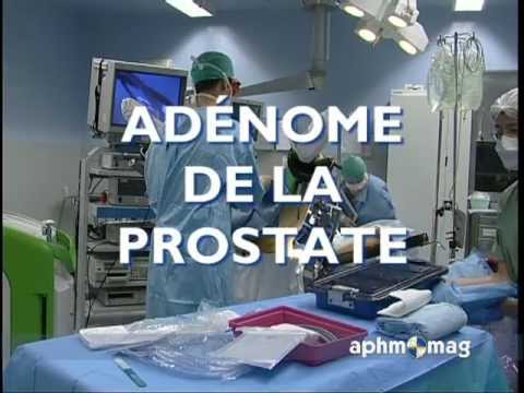 Prostata bei Männern, wie man schön Prostate Größe einer Erbse