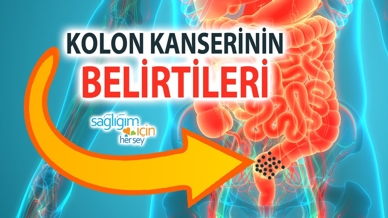 Kolon Kanseri Hangi Yakınmalara Yol Açar?