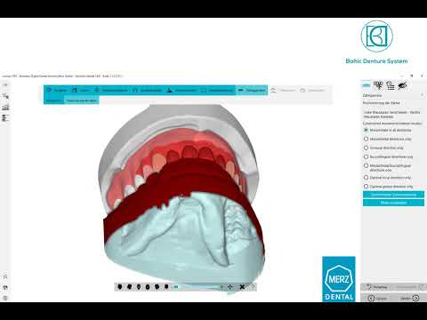 BDCreator PLUS: Individuelles Set-Up / individual set-up | #BalticDentureSystem #DigitalDenture