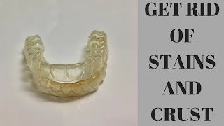 How To Clean Your Retainers