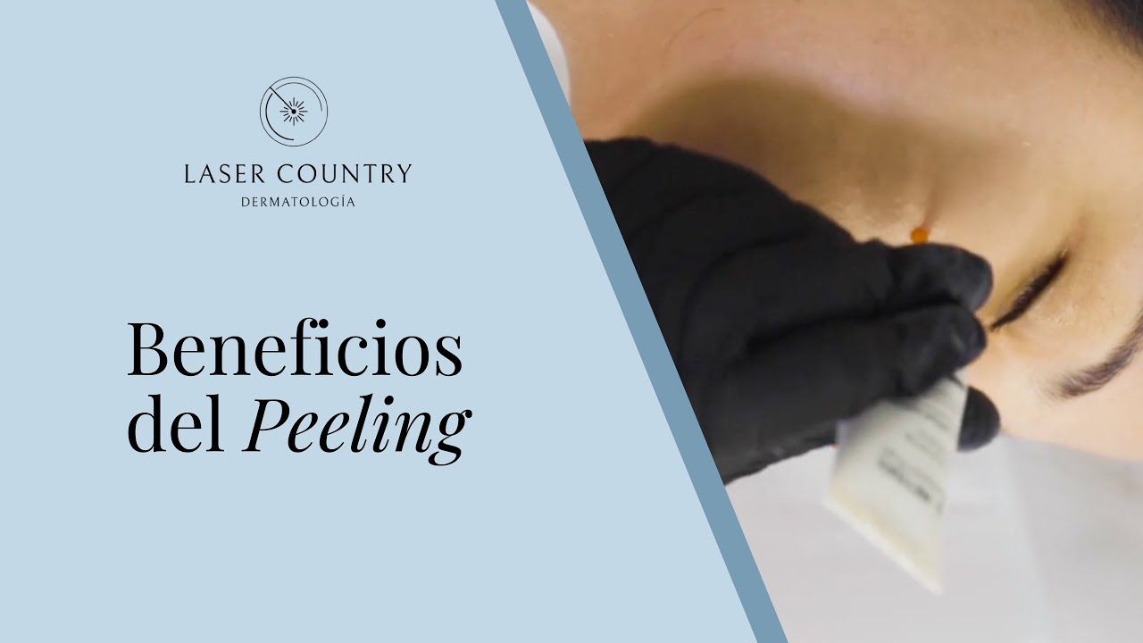 Hablemos de Peelings
