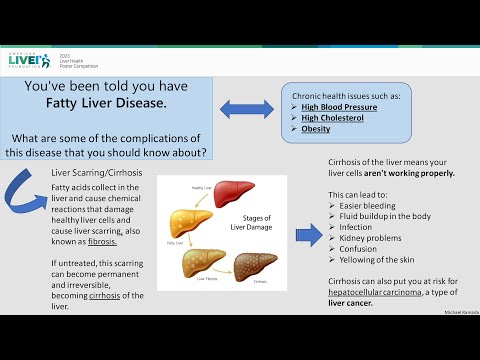 What are the health complications of NASH in adults? Michael Ramada, MD