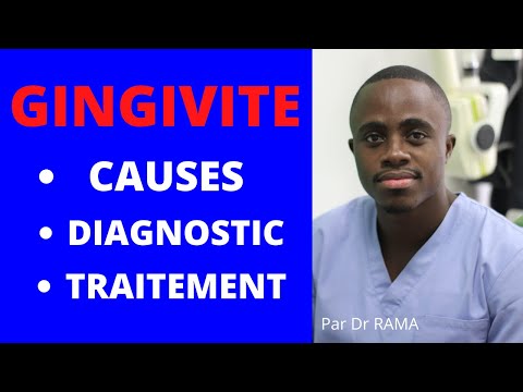La Gingivite: Causes et traitement de la gingivite