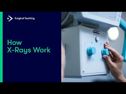 Medical X-Rays | How do they work?