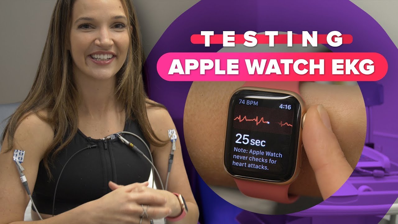 The Apple Watch ECG found something unexpected about my heart