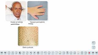 Eğitim Vadisi TYT Biyoloji 12.Föy Eşeye Bağlı Kalıtım Konu Anlatım Videoları