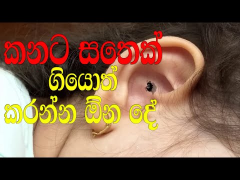 කනට සතෙක් ගියොත් කරන්න ඕන දේ - ඩොක්ටගෙන් අහන්න | Ask the doctor | Ear