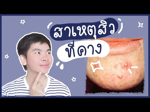 ค้อนของ ธ อร์ที่คุณสามารถซื้อใน Penza ยาต้มของสมุนไพรเพื่อความแข็งแรง