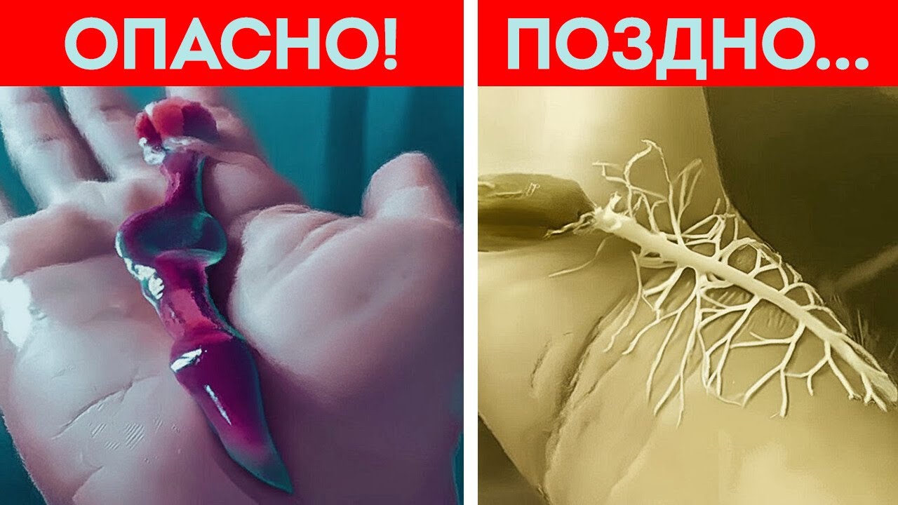 Природа кажется безопасной… пока вы не дотронетесь до этого