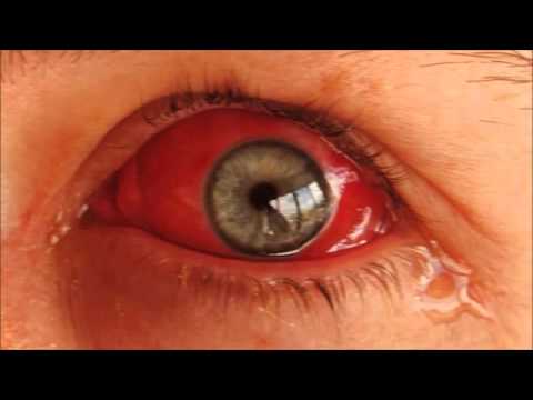 LUPA VERMELHA RENACER RAP part. DUCKJAY ( NOVA 2013)