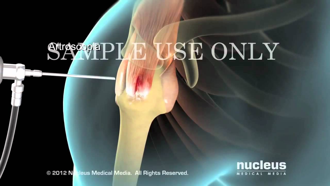 Marco Antonio Altamirano Cruz-19