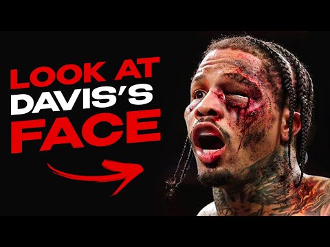 Gervonta Davis vs PURE VIOLENCE — Survival Mode