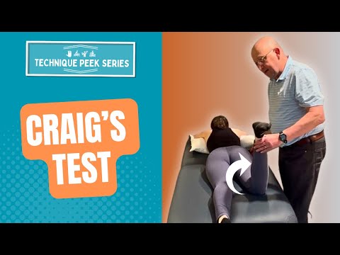 How to Assess for Femoral Anteversion/Retroversion - Craig's Test | Technique Peek Series